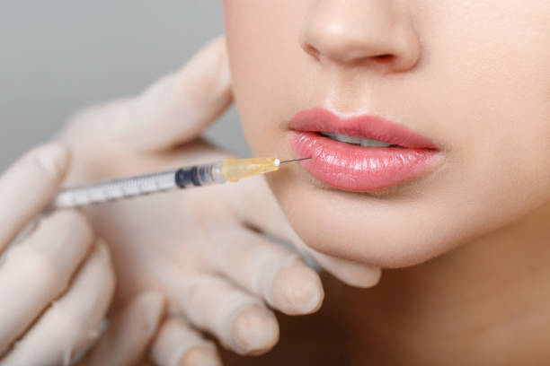 Can lip filler Improve Lip Contours and Shape