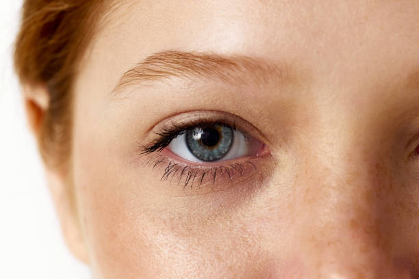 Does Eyelid Surgery Help Create a More Alert Look