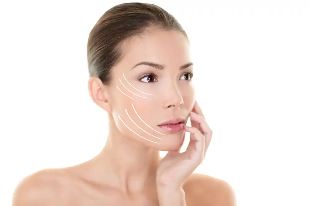 Sugar Thread Lift in Abu Dhabi