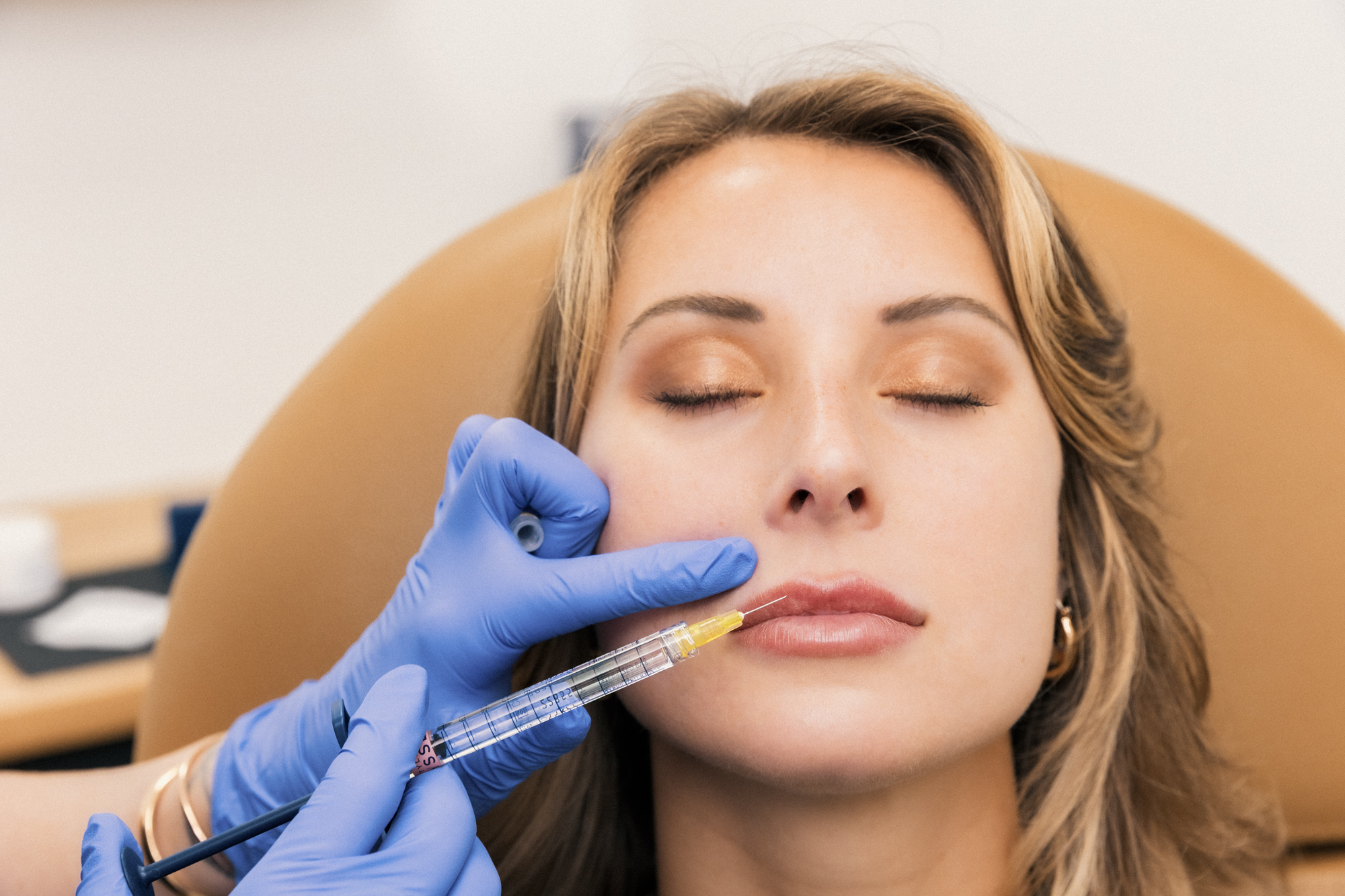 Russian lip Fillers in Abu Dhabi