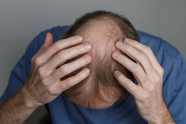 Can GFC Treatment for Hair Repair Chemically Damaged Hair