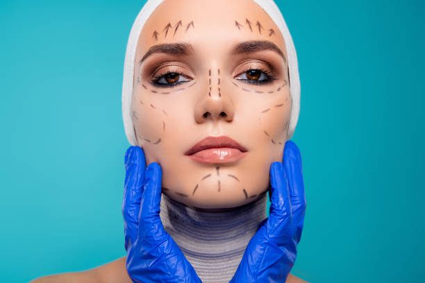 Are Facelifts a Permanent Anti-Aging Solution