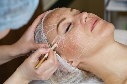 Can a Facelift Improve Facial Contours Lost With Age