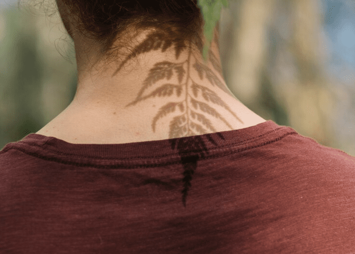 vitiligo neck